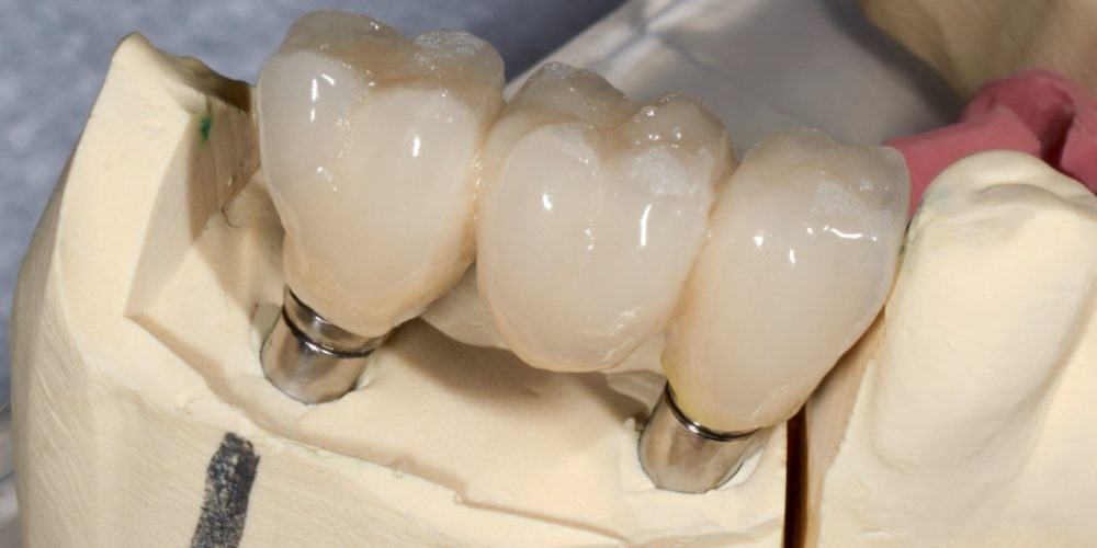 Imagen en miniatura de entrada