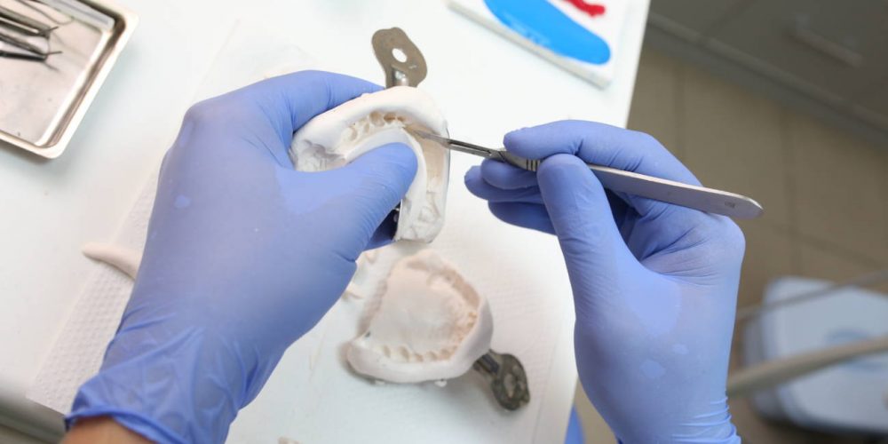 Imagen en miniatura de entrada